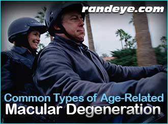 common-types-age-related-macular-degeneration