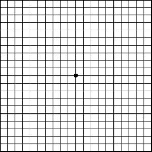 amsler-grid-sample