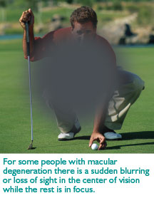 macular-degeneration