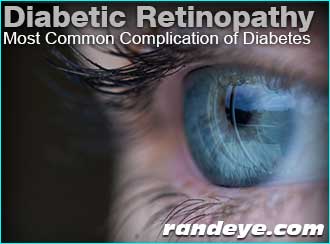 diabetic-retinopathy-common-diabetes