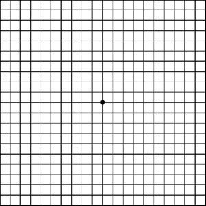 amsler-grid-sample