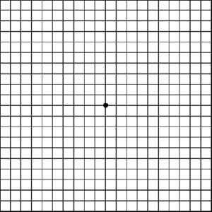 amsler-grid-sample
